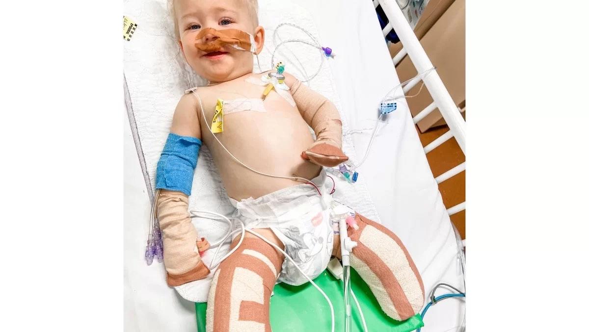 Após infecção Bebê precisa amputar pés e dedos das mãos