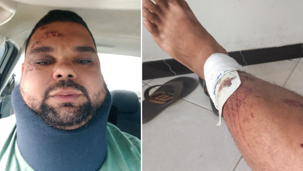 Trabalhador que salvou duas vidas precisa de ajuda para se reerguer em Boa Esperança