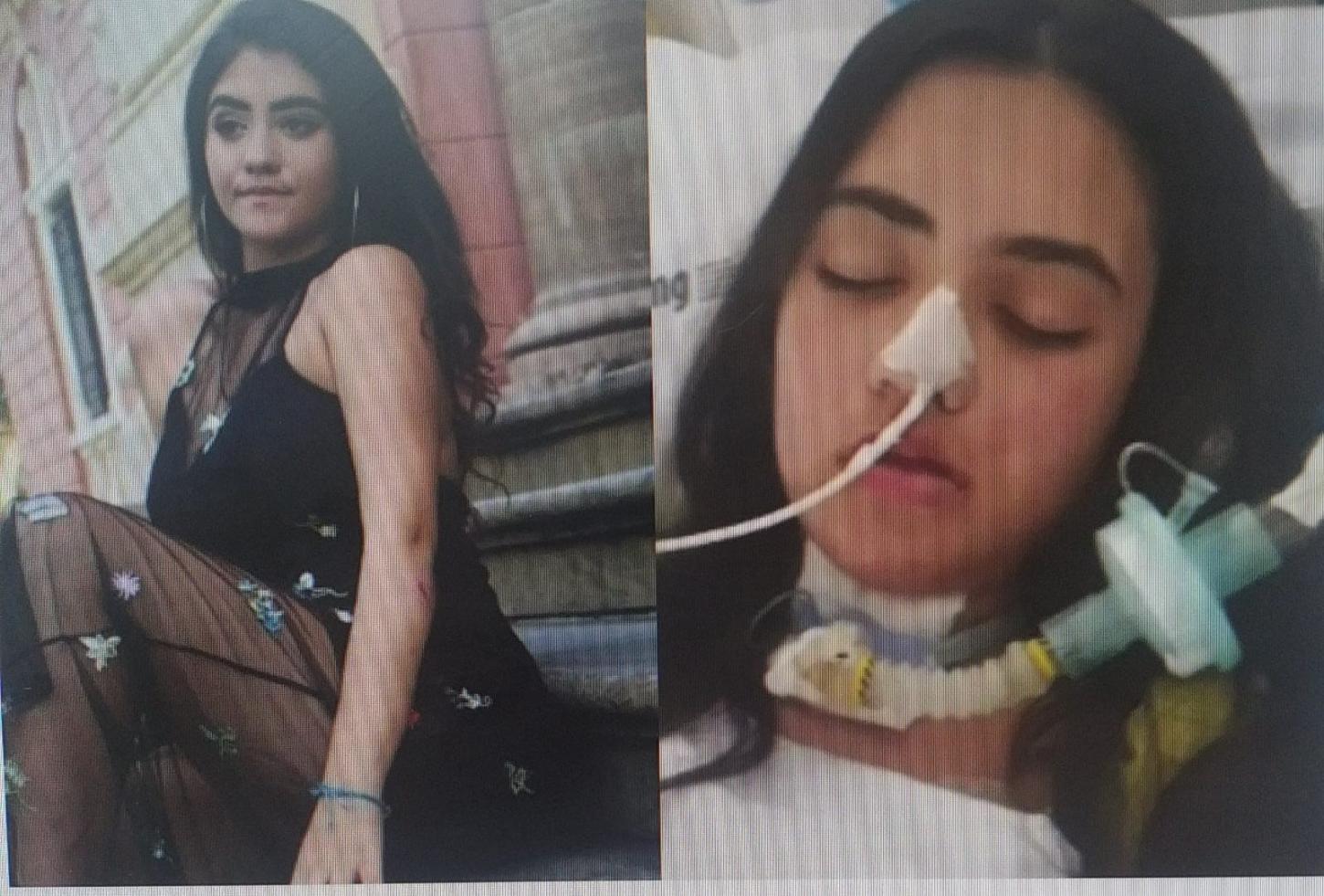Dengue neurológica rara deixa jovem tetraplégica e em coma por 7 meses