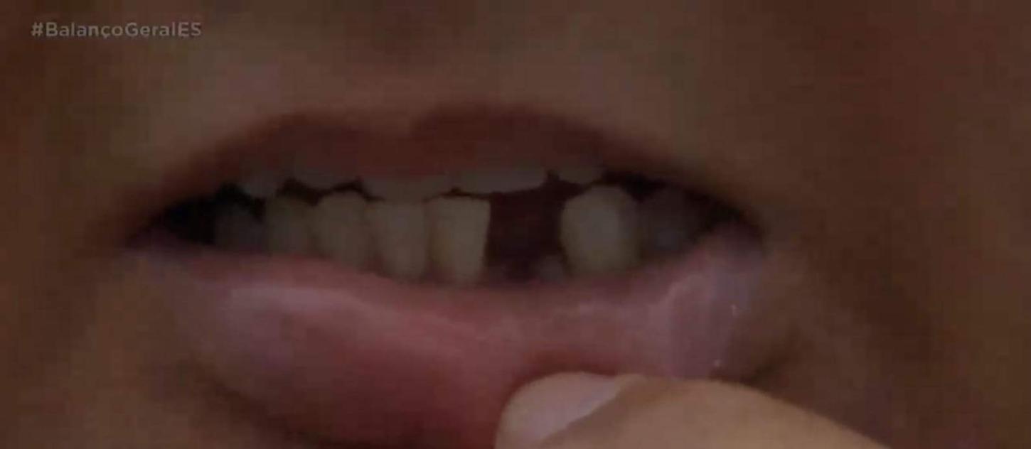 Mulher perde dente em briga com o marido em Vila Velha; agressor pediu para ser preso