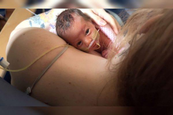 Bebê nasce com órgãos para fora, é enrolada em filme PVC e sobrevive