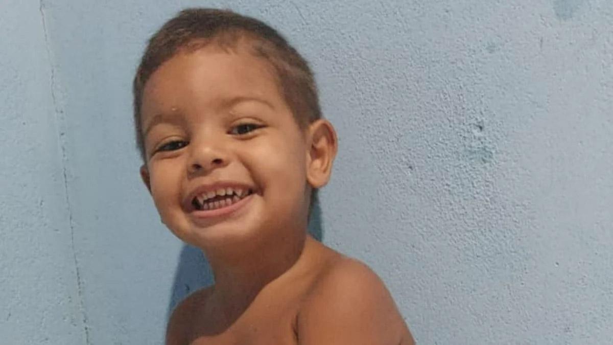 Menino de 2 anos fica gravemente ferido em acidente doméstico