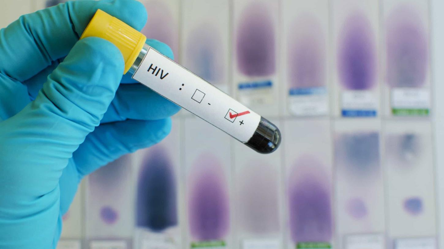 Espírito Santo registrou 913 novos casos de HIV em 2024