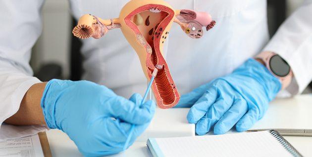 A cada 100 mil mulheres 15 podem ter câncer de colo de útero